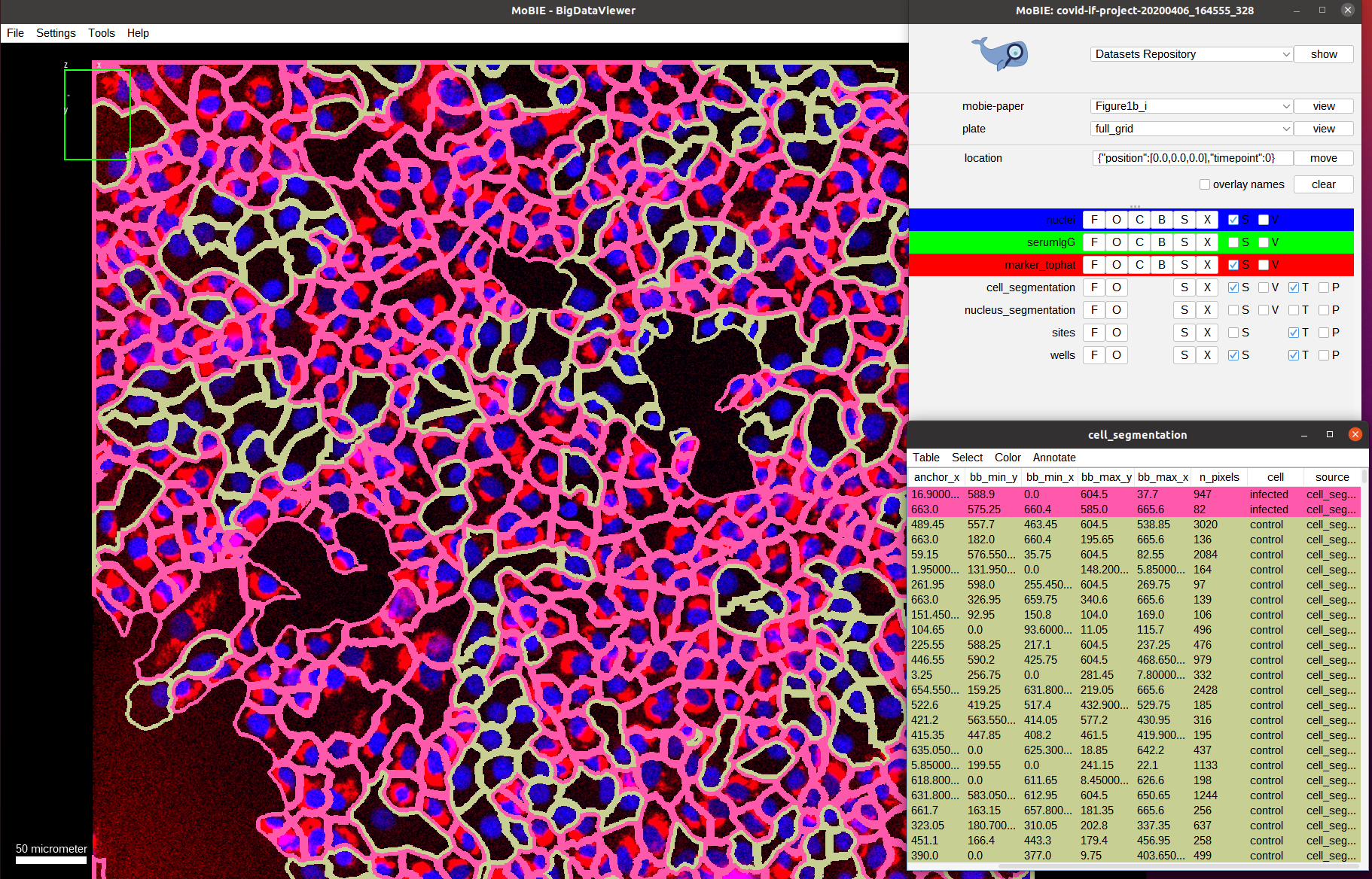 Cell segmentation overlay with infection classification