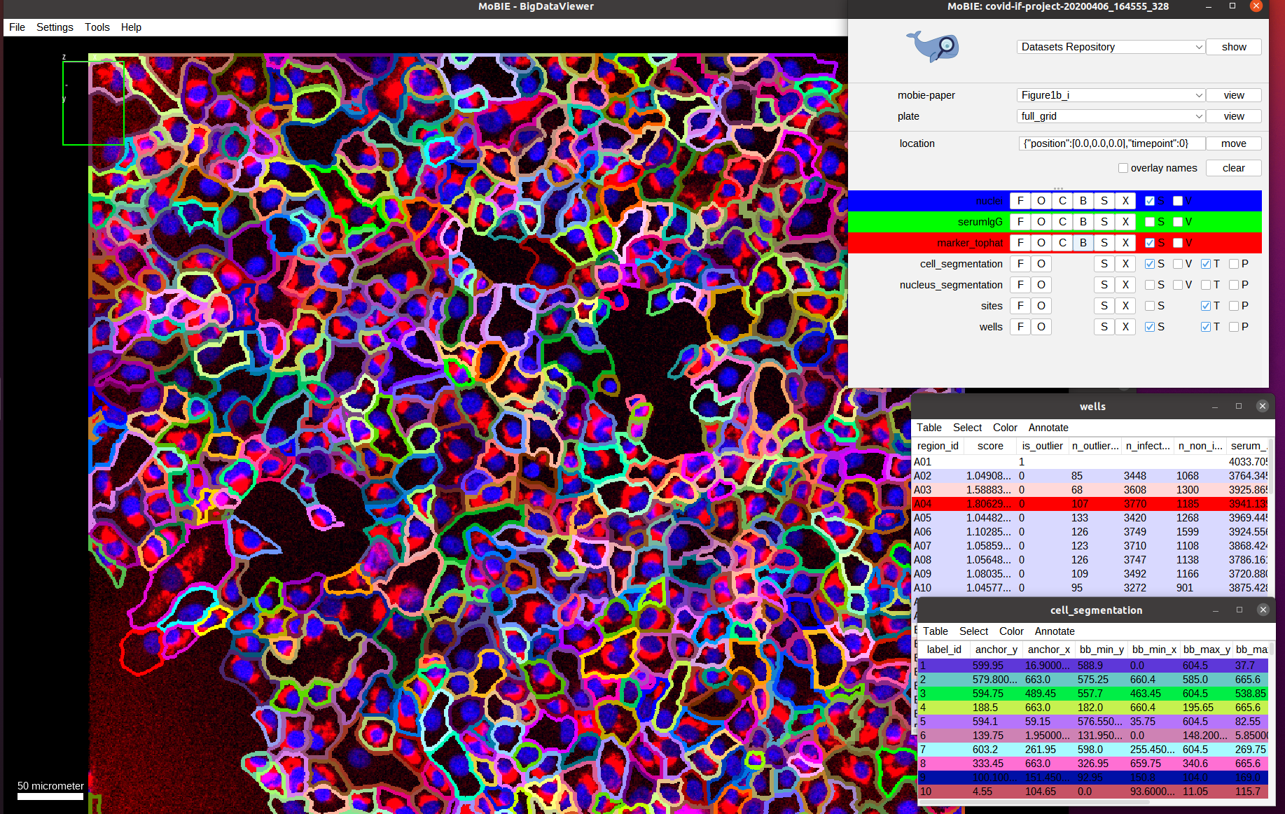 Cell segmentation overlay